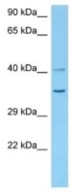 Olfactory receptor 6 Rabbit anti-Mouse, Polyclonal, Novus Biologicals 100 &mu;g | Buy Online | Novus Biologicals | Fisher Scientific